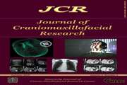  Examining facial soft tissue changes following orthognathic class III (bimax) surgeries applying structured light technique for the design and implementation of 3d facial modeling software 