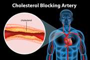 Atorvastatin Inhibits Viability and Migration of MCF7 Breast Cancer Cells