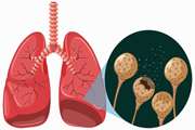 Expression of Two Basic mRNA Biomarkers in Peripheral Blood of Patients with Non-Small Cell Lung Cancer Detected by Real-Time RT-PCR, Individually and Simultaneously