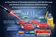In Vitro Effects of Photobiomodulation with 660 Nm Laser and Vitamin D on Osteoblastic Differentiation of Human Periodontal Ligament Stem Cells