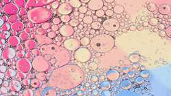 Histopathological Comparison between Bone Marrow  and Periodontium derived Stem Cells for Bone Regeneration in Rabbit Calvaria