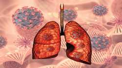 Identification of diagnostic and prognostic biomarkers in lung adenocarcinoma through integrated bioinformatics analysis and real time PCR validation
