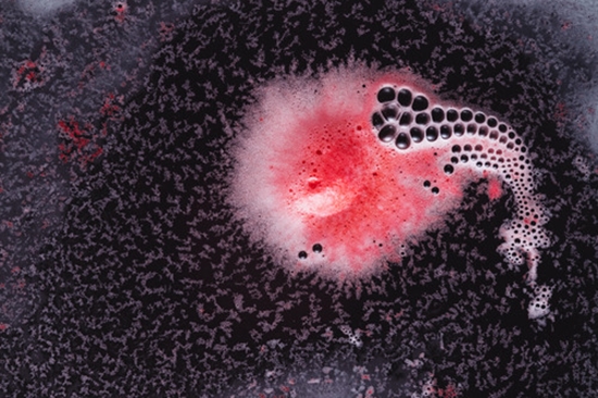 Comparison of the Expression of Cytokeratin 6 and 16 in Oral Lichen Planus Oral Lichenoid Lesions with Dysplasia and Oral Squamo {faces}