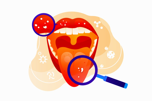 Evaluation of NCBP2 Gene Expression in Patients with Oral Squamous Cell Carcinoma Compared to Healthy Individuals